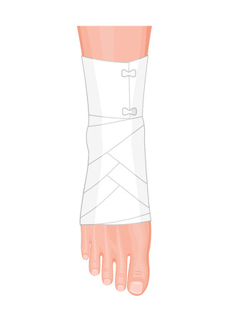 Correct way to wrap an ankle by flexible elastic supportive orthopedic bandage (sprain, strain). Stock Photo