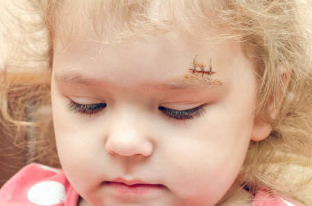 1 599 715 人間の皮膚 の写真素材 ストックフォト 123rf