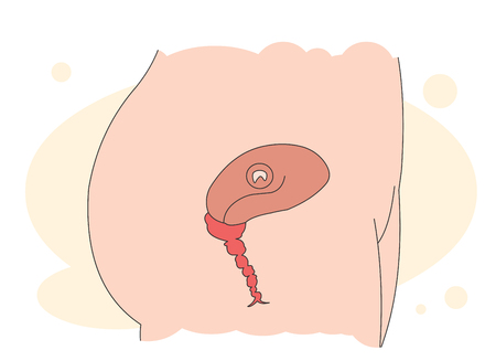 Initial stage of pregnancy