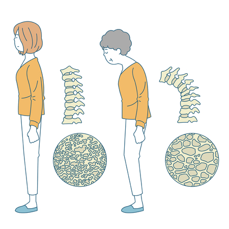 個人の健康と衛生のイラスト 背中の骨 姿勢 背骨 のイラスト素材 ベクタ Image 個人の健康と衛生のイラスト 背中の骨 姿勢 背骨 のイラスト素材 ベクタ Image