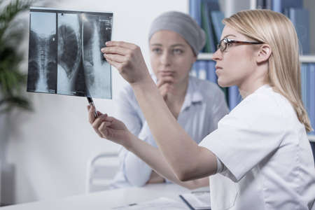 Young doctor looking at her patient s xray photo Stock Photo Young doctor looking at her patient's xray photo Stock Photo - 42293246