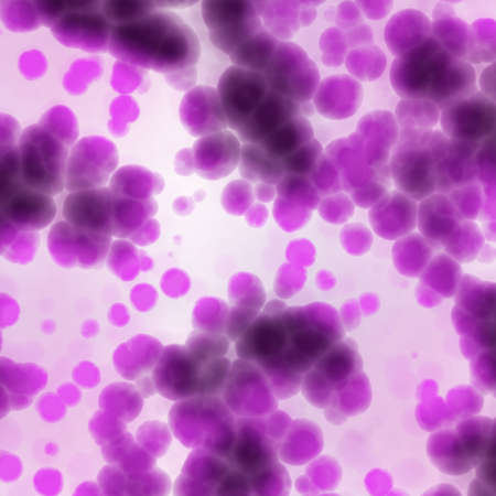 biol 405 pyelonephritis paper biol 405 pyelonephritis paper