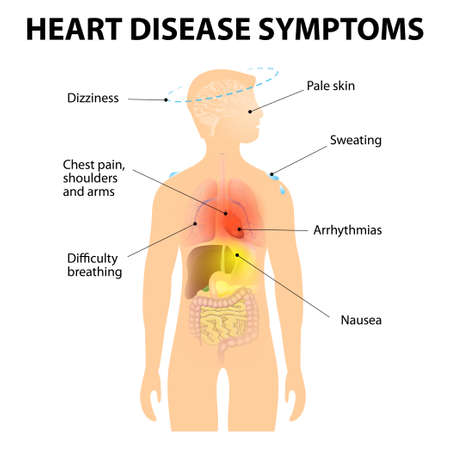 a report on arrhythmia causes and effects on the human body Toxic black mold symptoms toxic black mold causes serious through the skin is one of the three main ways that toxic black mold mycotoxins enter the human body. a report on arrhythmia causes and effects on the human body Toxic black mold symptoms toxic black mold causes serious through the skin is one of the three main ways that toxic black mold mycotoxins enter the human body.