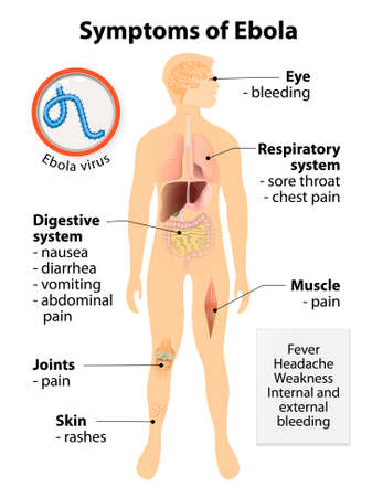 ebola virus disease. signs and symptoms. human silhouette with ebola virus disease. signs and symptoms. human silhouette with, Muscles