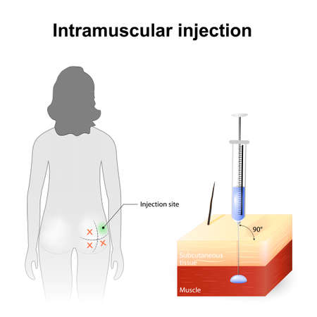intramuscular injection angle and depth of injections technique