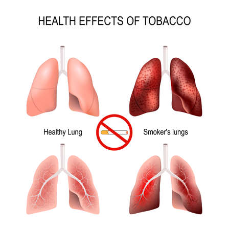 health effects of smoking healthy lungs and smokers lungs no