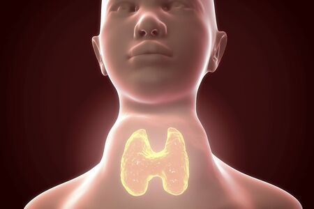 有毒びまん性甲状腺腫 Flajani バセドウ バセドウ病 3 D イラスト表示拡大しない Thryoid 腺甲状腺機能亢進症の女性 の写真素材 画像素材 Image