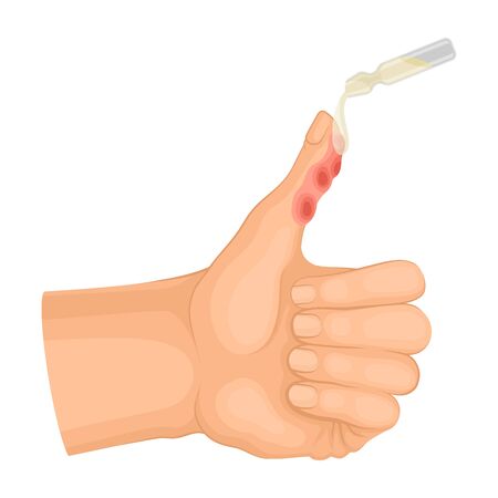 500 患者をやけど のイラスト素材 ベクター 123rf 500 患者をやけど のイラスト素材 ベクター 123rf