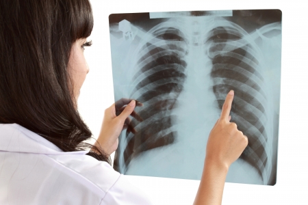 Female doctor carefully x ray of patient in isolated abckground Stock Photo Female doctor carefully x-ray of patient in isolated abckground Stock Photo - 11318402