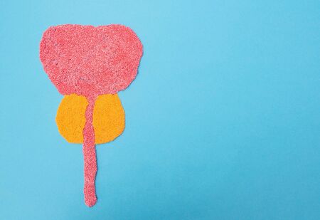 prostate adenoma prostate adenoma