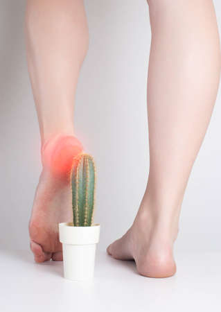 足裏　少女 少女は足でサボテンを踏む。足裏とかかとの痛み、代謝障害、かかとのひび割れの概念の写真素材・画像素材 Image 183016800