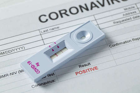 Rapid antigen test kit for check coronavirus result is positve with report document.covid-19 ag with nasal rapid test.healthy fast checking virus disease infection.