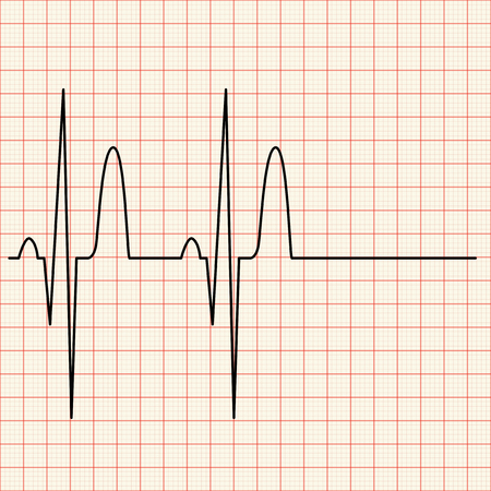 stethoscope and heart on graph paper illustration royalty free free digital graph paper