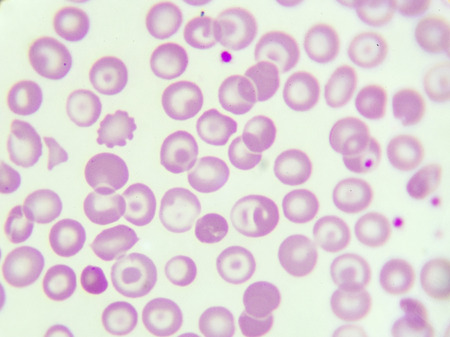 target cell target cell