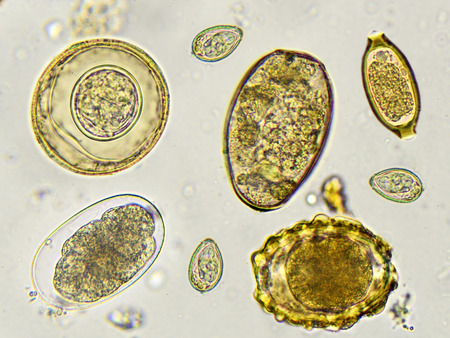 Los huevos de helmintos en las heces