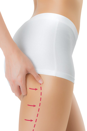 女性 図面の矢印 重量を失う脂肪吸引と彼女のお尻の皮膚をつかんでセルライト除去概念 白い背景に分離します の写真素材 画像素材 Image 女性 図面の矢印 重量を失う脂肪吸引と彼女のお尻の皮膚をつかんでセルライト除去概念 白い背景に分離します の写真素材 画像素材 Image