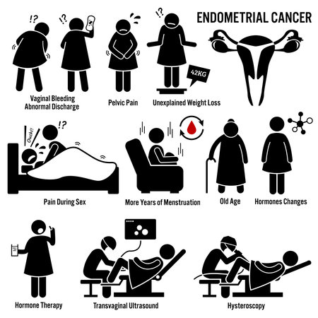 Uterine Cancer Risk Factors