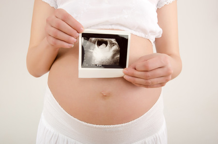 Gros Plan Sur Le Ventre Enceinte De L Echographie Du Bebe Femme Qui Attend Un Bebe Vetu De Blanc Tenant La Echographie Du Bebe A Naitre Banque D Images Et Photos Libres De Droits
