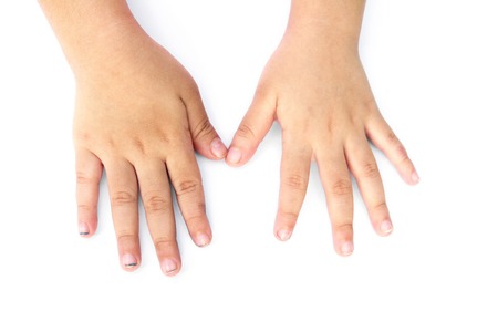 子供たちの長い爪で孤立した白い背景 子供たちは 分離爪を汚い 汚れた爪が分離されました 子供の爪の分離 の写真素材 画像素材 Image 子供たちの長い爪で孤立した白い背景 子供たちは 分離爪を汚い 汚れた爪が分離されました 子供の爪の分離 の写真素材 画像素材 Image