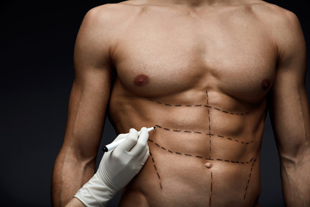 人間の体 男のクローズ アップの美しさの操作の前に肌に腹筋 筋肉胴や鉛筆の線で体をフィットします 手は男性の患者さんの肌に手術線を描く 整形手術 高分解能 の写真素材 画像素材 Image 人間の体 男のクローズ アップの美しさの操作の前に肌に腹筋 筋肉胴や鉛筆の線で体をフィットします 手は男性の患者さんの肌に手術線を描く 整形手術 高分解能 の写真素材 画像素材 Image