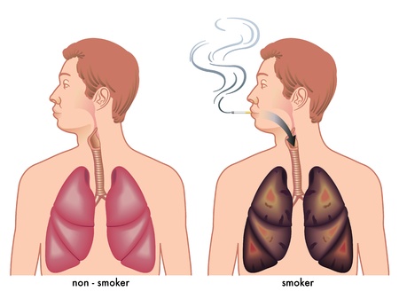 Smoking Stock Vector Smoking Stock Vector - 11731117