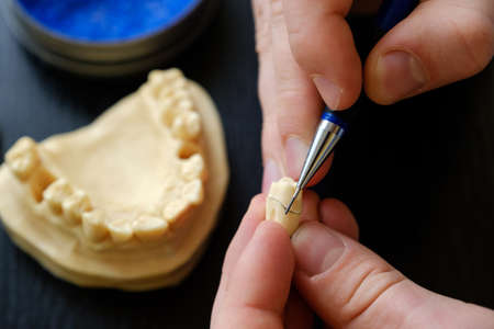 The dental technician is engaged in a modeling of artificial dentures. the hands of a dental technician close-up. quality control of the neck of the tooth. Zdjęcie Seryjne