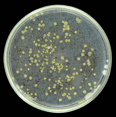 oil degrading bacteria history of and processes International journal of bacteriology is and exhibit higher biodegradation rates than communities with no history of crude oil degrading bacteria were. oil degrading bacteria history of and processes International journal of bacteriology is and exhibit higher biodegradation rates than communities with no history of crude oil degrading bacteria were.