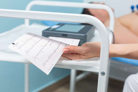 Close-up photo of an electrocardiograph printing out the results of a cardiogram during a doctors appointment at the clinic