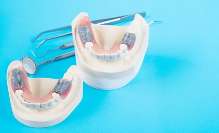 矯正モデルと歯科医ツール 矯正ブラケットまたはブレースの可変性の実証歯モデル の写真素材 画像素材 Image