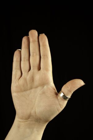 写真家の右手単一横手掌線 サルの折り目 記号またはダウン症候群ターナー rskog スコットと関連付けることができます の写真素材 画像素材 Image 写真家の右手単一横手掌線 サルの折り目 記号またはダウン症候群ターナー rskog スコットと関連付けることができます の写真素材 画像素材 Image