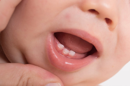 乳歯で赤ちゃんの口 の写真素材 画像素材 Image 乳歯で赤ちゃんの口 の写真素材 画像素材 Image