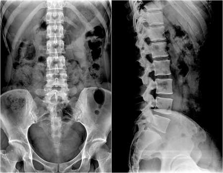 X 線 Mri 検査 - イメージの背骨の痛みや腰の骨 の写真素材・画像素材 