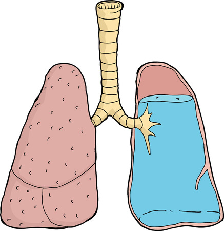 タバコとタバコと分離汚い肺 のイラスト素材 ベクタ Image タバコとタバコと分離汚い肺 のイラスト素材 ベクタ Image