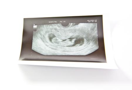 12 Semaines Bebe Echographie Image Banque D Images Et Photos Libres De Droits Image 3545 12 Semaines Bebe Echographie Image Banque D Images Et Photos Libres De Droits Image 3545