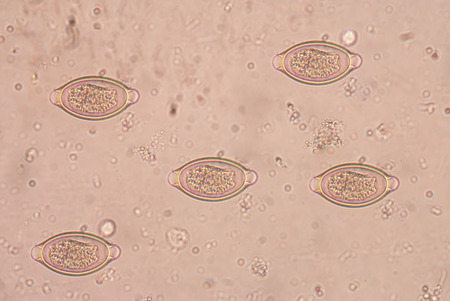a trichocephalosis is a torok giardiasis