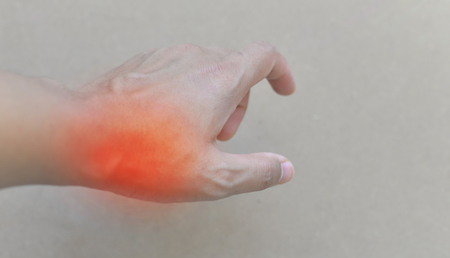 痛風患者の足 痛みと炎症を起こして痛風を閉じます の写真素材 画像素材 Image