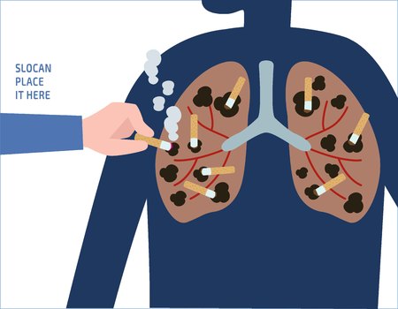 Damage of smokinginternal health concept vector people flat design illustration isolated background. Stock Vector - 93705601