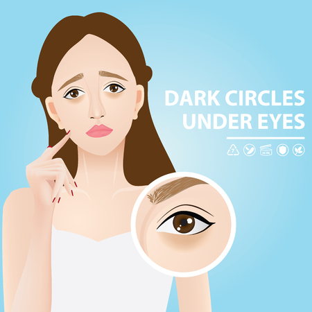 Dark circles under eyes vector illustration